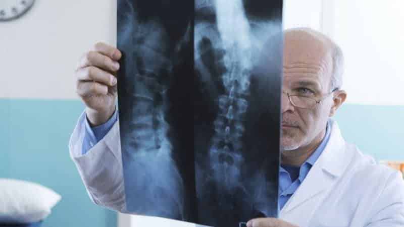 Как лечить артроз поясничного отдела