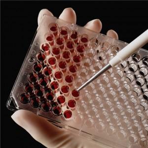 Как лечить остеопороз плечевого сустава