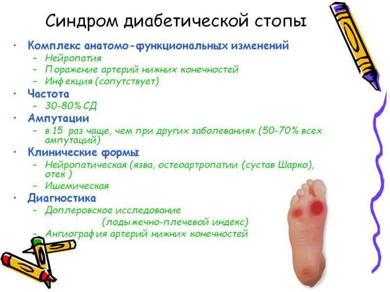 Как лечить диабетическую стопу