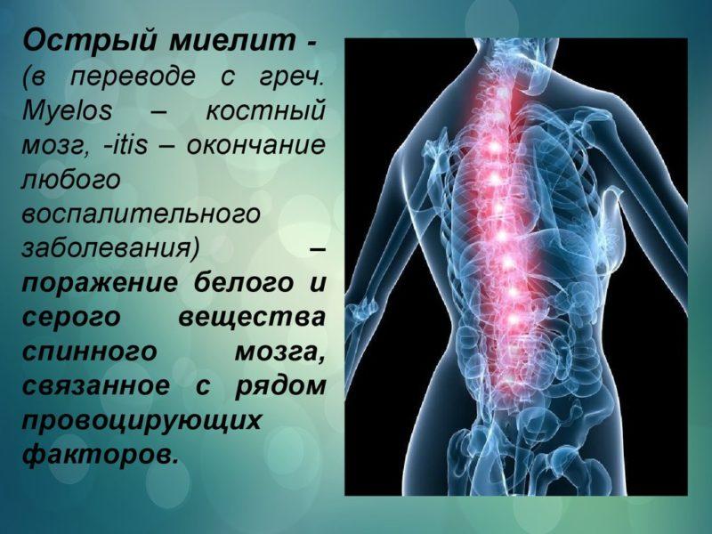 Заболевания спинного мозга