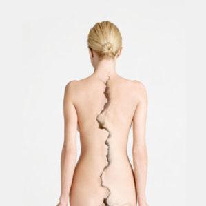 Как лечить воспаление позвоночника