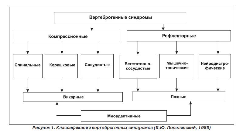 Как лечить вертеброгенный болевой синдром