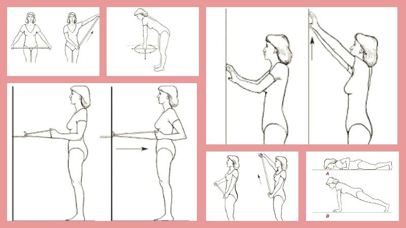 Как проходит эндопротезирование плечевого сустава