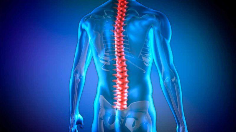 Что такое нижний парапарез и как его лечить