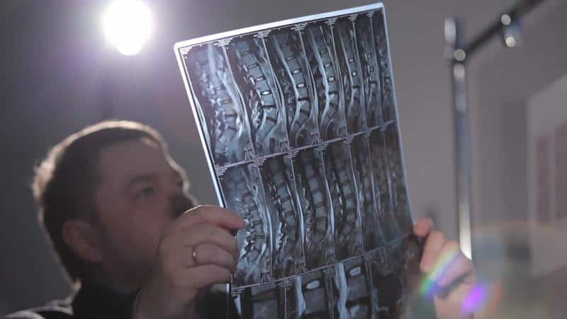 Что такое нижний парапарез и как его лечить