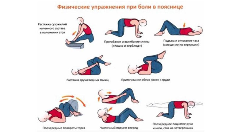 Что такое дискогенная радикулопатия