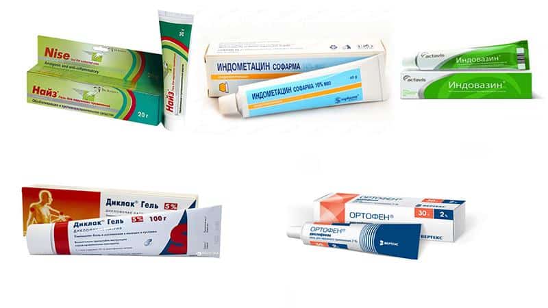 Какие мази можно использовать для лечения остеохондроза