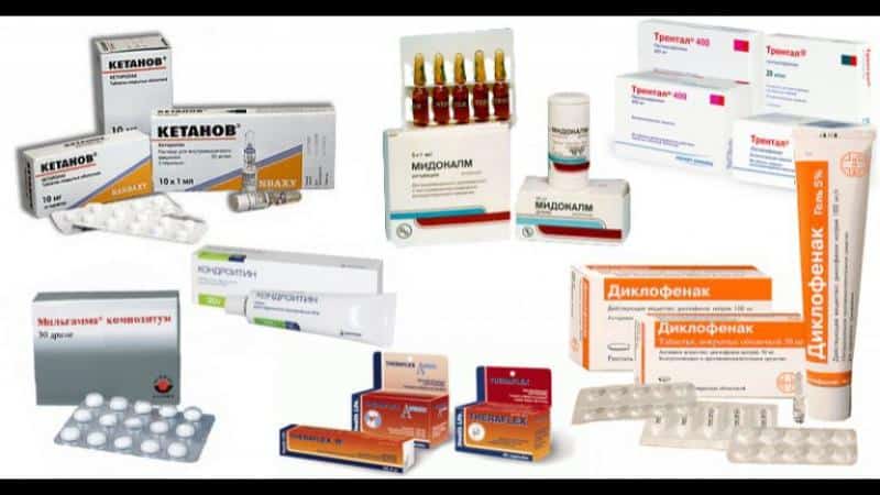 Как лечить артроз коленного сустава