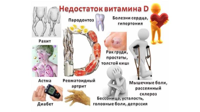 Как лечить недостаток витамина Д