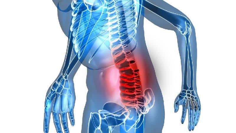Как лечить стеноз позвоночного канала поясничного отдела