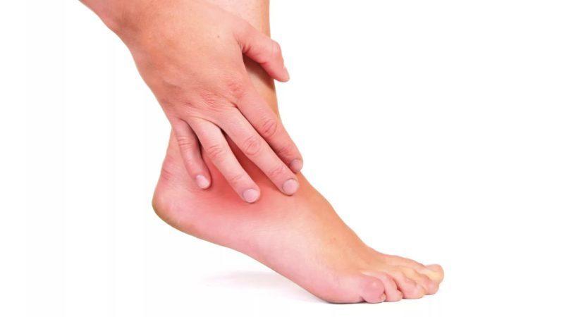 Как лечить гигрому стопы