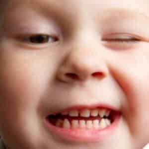 Что делать, если хрустит челюсть