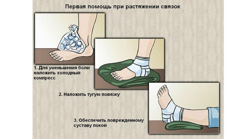 Как оказывать первую помощь при ушибах, растяжениях и вывихах