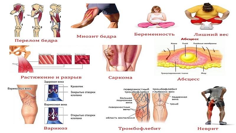 Что делать, когда ноет нога от бедра до колена