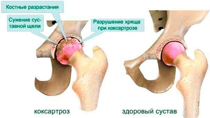 Болезни суставов и костей: какие бывают и какой врач лечит