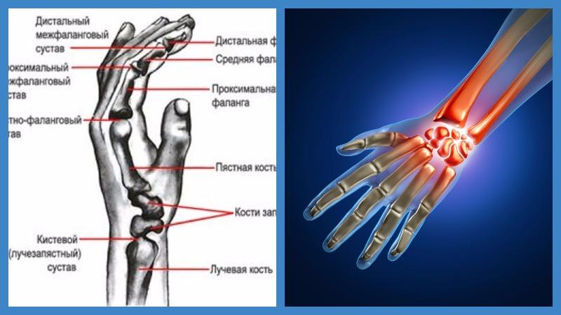 Болезни суставов и костей: какие бывают и какой врач лечит