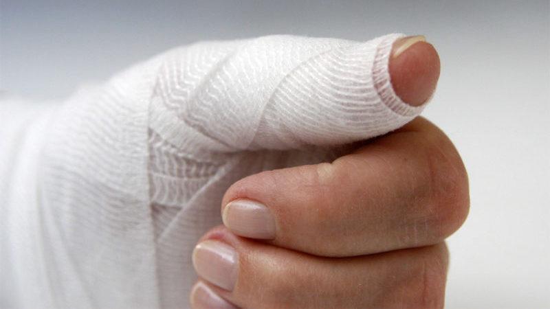 Что делать при вывихе пальца