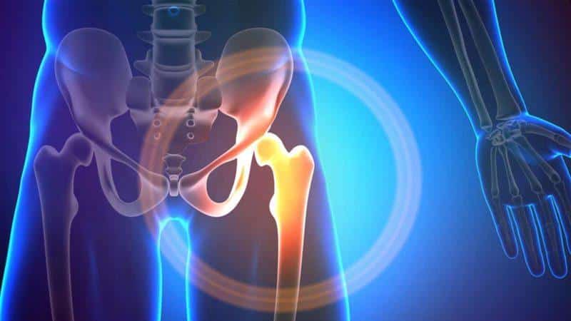 Что такое хондрома и как её лечат