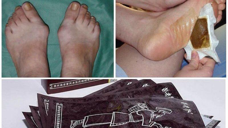 Как использовать китайский магнитный пластырь Hyperosteogeny