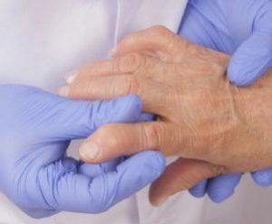 Как лечат синдром Фелти