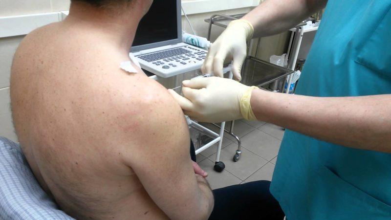 Как лечить боль в мышцах плеч