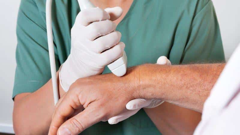 Как лечить бурсит кисти руки и пальцев