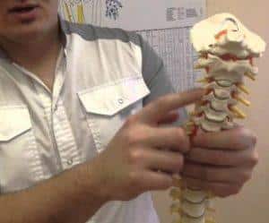 Как лечить синдром позвоночной артерии