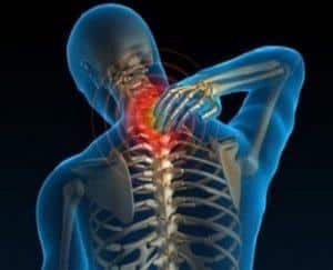Как лечить конкресценцию позвонков
