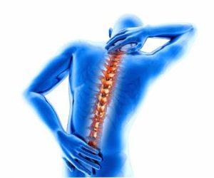 Как лечить конкресценцию позвонков