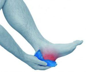 Как лечить плантарный фасциит