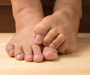 Как лечить полинейропатию нижних конечностей