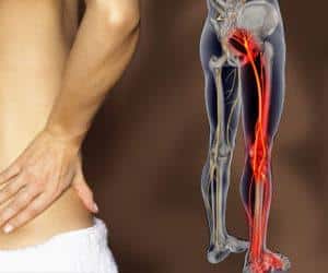 Как лечить синдром Рота-Бернгардта