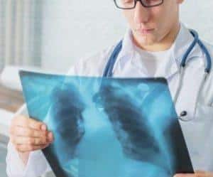 Как лечить синдром Титце