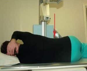 Как лечить синдром Титце