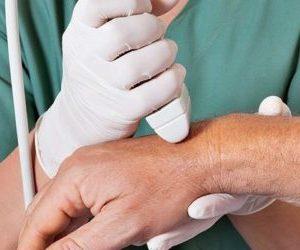 Как лечить стилоидит лучезапястного сустава