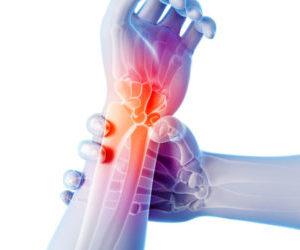 Как лечить суставы перекисью водорода