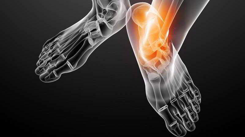 Как лечить тендинит стопы