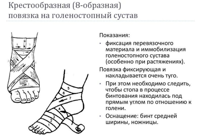 Как лечить ушиб голеностопного сустава