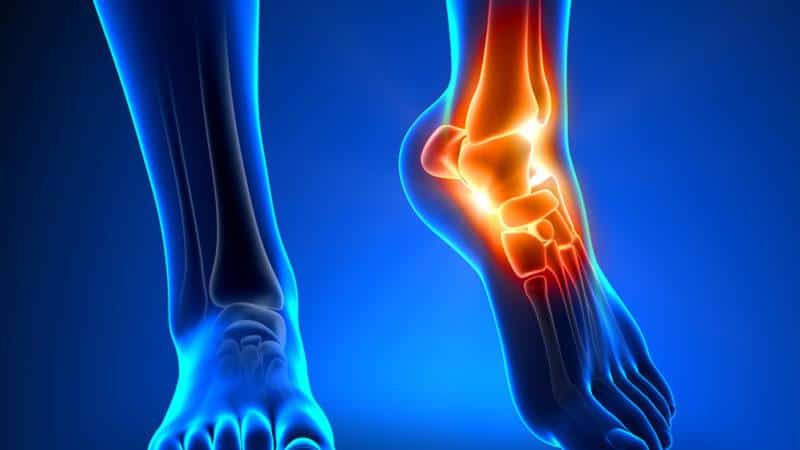 Как лечить ушиб голеностопного сустава