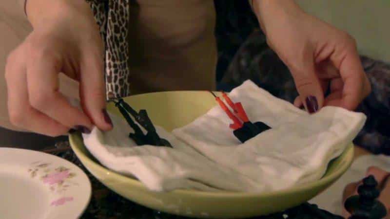 Как лечить ушиб локтевого сустава