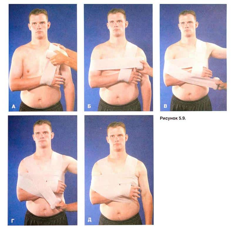 Как лечить вывих предплечья