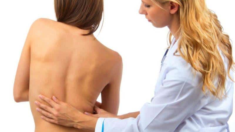 Как сколиоз влияет на беременность