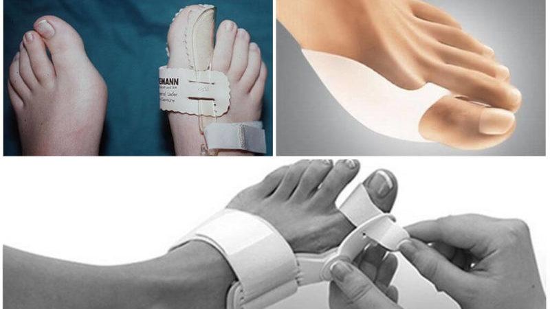 Как выбрать вальгусную шину