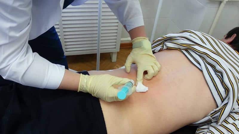 Какие уколы делают при грыже позвоночника