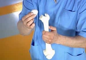 Что такое остеопения
