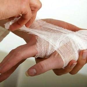 Как лечить артрит на пальцах рук