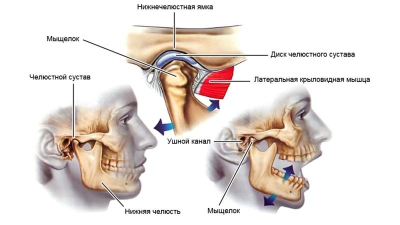 Как лечить артрит челюстного сустава