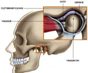 Как лечить артроз челюстного сустава