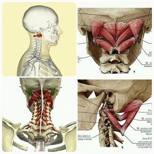 Как лечить смещение позвонка атлант
