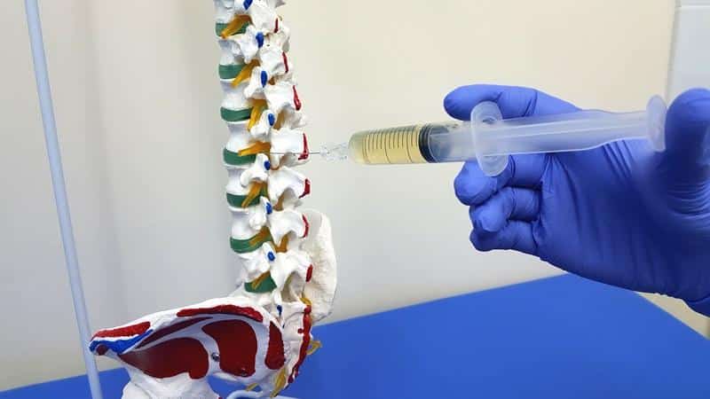 Что такое блокада позвоночника при грыже